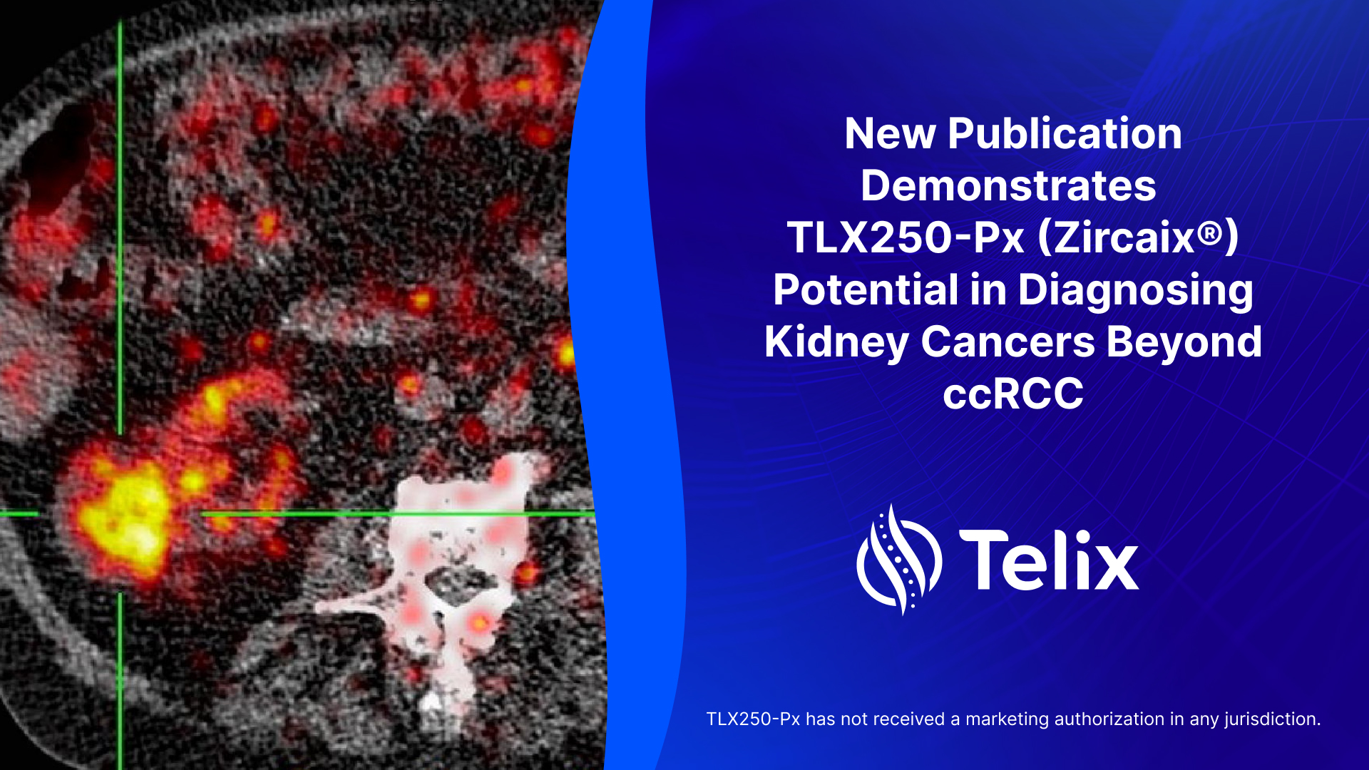New Publication Demonstrates TLX250-Px (Zircaix®) Potential in
